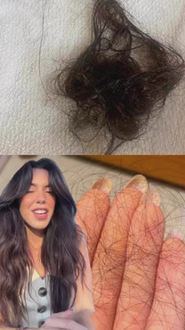 kit prevenção de queda